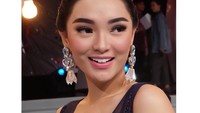 Pedangdut Zaskia Gotik juga ikutan tren veener gigi kelinci lho. Kalau di Indonesia kan mahal, jadi ke Thailand benerin gigi, katanya dalam salah satu wawancara. (Foto: Instagram)