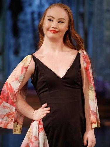 Mimpi Besar Model Down Syndrome Bisa Cetak Sejarah di Show Victoria's Secret