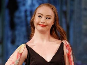 Mimpi Besar Model Down Syndrome Bisa Cetak Sejarah di Show Victorias Secret