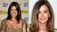 Supermodel Janice Dickinson menjalani berbagai prosedur seperti pembesaran payudara, face-lifts, sedot lemak hingga membuat wajahnya meruncing. Namun kini ia menyesali hal tersebut, karena ia didiagnosa mengalami kanker payudara. Dok. Getty Images