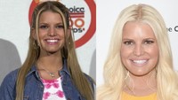Jessica Simpson menjalankan serangkaian operasi plastik demi tampil sempurna, namun ia justru menyesali perubahan pada bibirnya itu. Dok. Getty Images