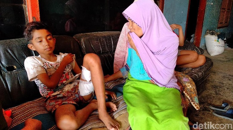 Bocah MI Malang Dikeroyok 6 Anjing Pemburu: Saya Pukul dengan Sandal Bocah MI Malang Dikeroyok 6 Anjing Pemburu: Saya Pukul dengan Sandal