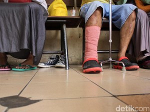Kenali Gejala Penyakit Tulang Pada Anak yang Bisa Kambuh saat Dewasa