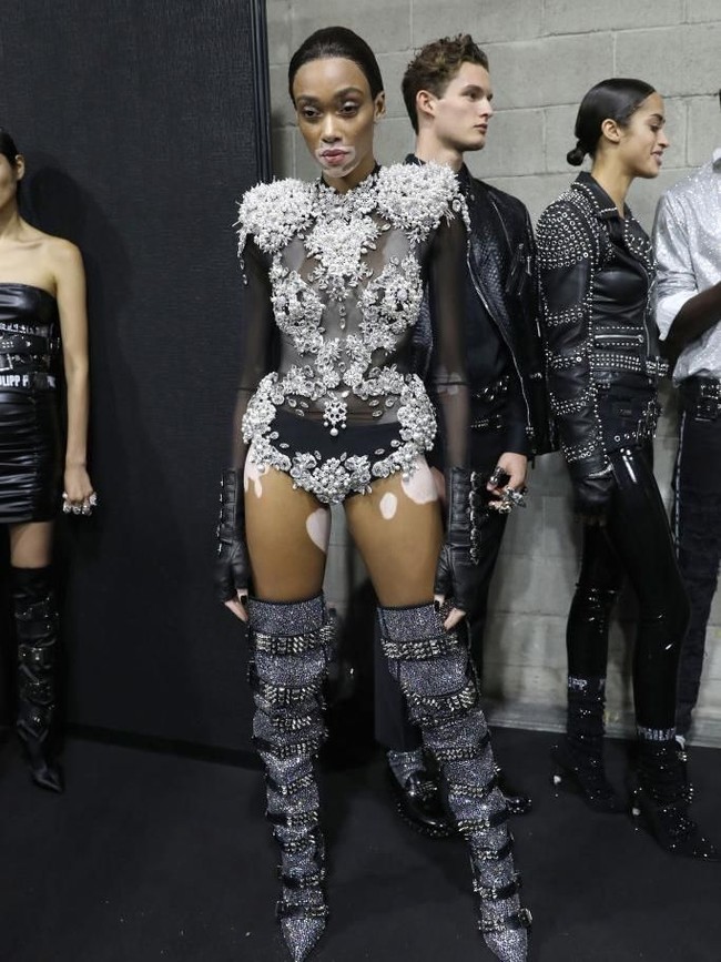 Winnie Harlow menjadi pusat perhatian di fashion show Phillipp Plein yang digelar dalam rangkaian Milan Fashion Week baru-baru ini. Ia tampil seksi dalam balutan bodysuit transparan sehingga mengekspos kulitnya yang mengalami vitiligo. Kelainan kulit ini menyebabkan depigmentasi yang tak merata sehingga kulitnya tampak belang. (Foto: Getty Images)