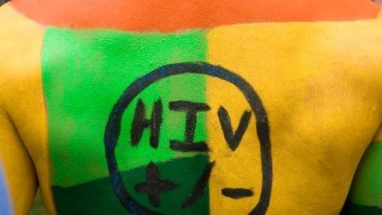 Kasus HIV di Australia Turun Signifikan 5 Tahun Terakhir Kasus HIV di Australia Turun Signifikan 5 Tahun Terakhir