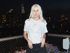 Foto: 10 Pesona Lauren Wasser, Model Difabel Berkaki Emas