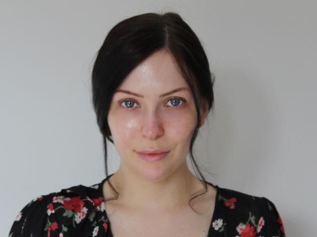 Inilah penampilan Sofia sebelum wajahnya melakukan beragam prosedur tadi. Sofia mengaku tidak PD dengan kulitnya yang kemerahan serta jerawat. Bagian hidung dan bibirnya juga ingin diberi sentuhan prosedur filler.  Foto: dok. Istimewa