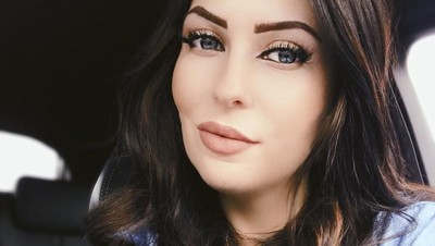 Foto Before-After Wanita yang Habiskan Rp 78 Juta Demi Punya Wajah Baru