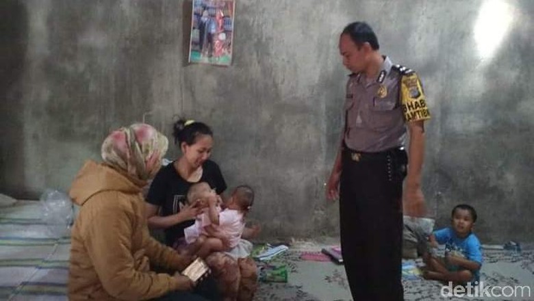 Ini Kondisi Terkini Kembar Siam Meisya dan Meikha di Gunungkidul Ini Kondisi Terkini Kembar Siam Meisya dan Meikha di Gunungkidul