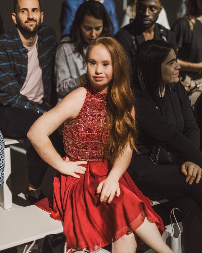 Meski banyak mendapat sambutan baik, Maddy mengungkap masih banyak pihak yang memandangnya sebelah mata. Ia pun berharap bisa diperlakukan sama dengan model lain. Masih ada beberapa orang yang tidak menganggapku serius. Aku berhak diperlakukan sama seperti model lain. Aku bekerja keras seperti yang lain, katanya dilansir Teen Vogue. Foto: Instagram @madelinesmodelling_