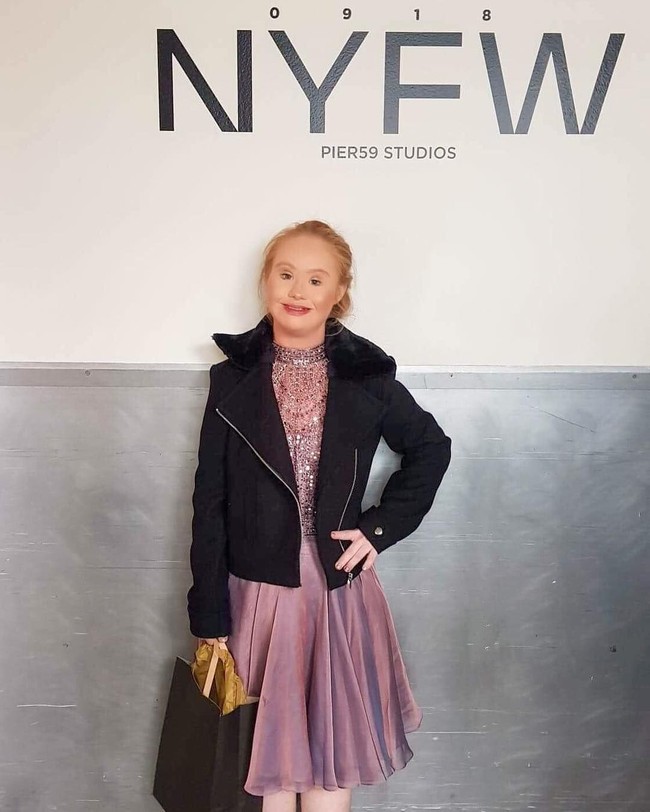 Rencanaku untuk masa depan adalah untuk tetap mengubah pandangan industri fashion melihat keberagaman. Aku ingin terus menjadi model dan kelihatannya aku akan sangat sibuk tahun depan, ungkapnya kepada Dailymail. Foto: Instagram @madelinesmodelling_