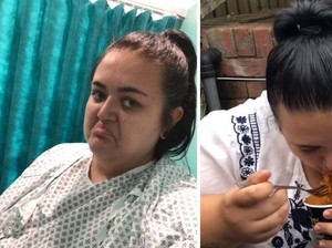 Ikut Tantangan Mie Pedas, Wanita Ini Masuk Rumah Sakit dan BAB Darah