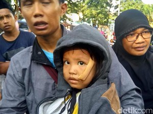 Trauma Bocah Korban Gempa Palu, Lupa Nama hingga Kehilangan Ortu