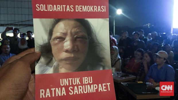 Gambar wajah lebam Ratna Sarumpaet dalam acara 'Solidaritas Demokrasi untuk Ibu Ratna Sarumpaet' di Menteng, Jakarta Pusat, Selasa (2/10). 