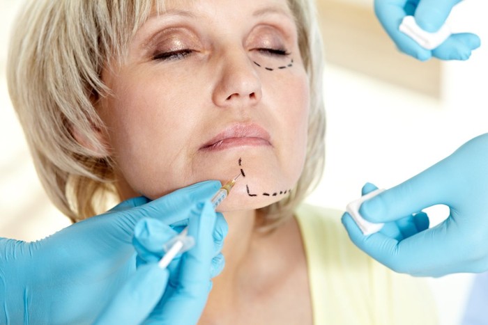 operasi plastik Close-up Of A Surgeon Drawing Perforation Lines On Young Womans Face For Plastic Surgery