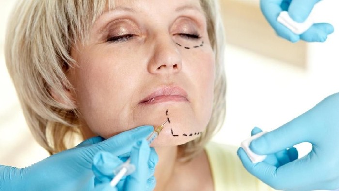 Close-up Of A Surgeon Drawing Perforation Lines On Young Womans Face For Plastic Surgery