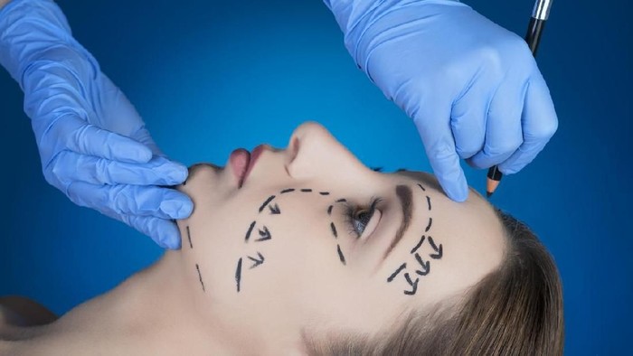 operasi plastik Close-up Of A Surgeon Drawing Perforation Lines On Young Womans Face For Plastic Surgery