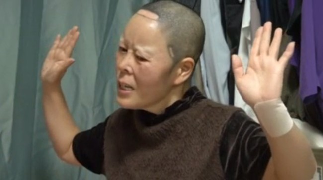 Berutang hingga 30 juta Won atau sekitar Rp 400 jutaan, Kim menjalani 15 operasi di wajahnya selama seharian. Namun setelah perban dilepas dari wajahnya dan dia bercermin, Kim tahu ada yang tidak benar dari operasinya. “Buruk sekali sampai orang juga tidak mau melihat wajahku. Ini bukan wajah manusia. Ini lebih buruk dari monster atau alien,” katanya dengan menangis. Foto: REUTERS/Kim Hong-Ji