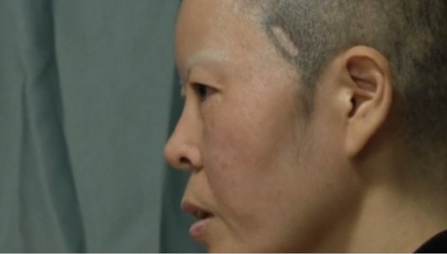 Inilah Kim Bok-soon yang berbagi kisah sedihnya pasca menjalani operasi plastik. Dalam wawancara dengan Reuters, Kim mengaku dia sampai meminjam uang alias berutang 30 juta Won atau sekitar Rp 400 jutaan demi melakukan prosedur kecantikan tersebut. Foto: REUTERS/Kim Hong-Ji