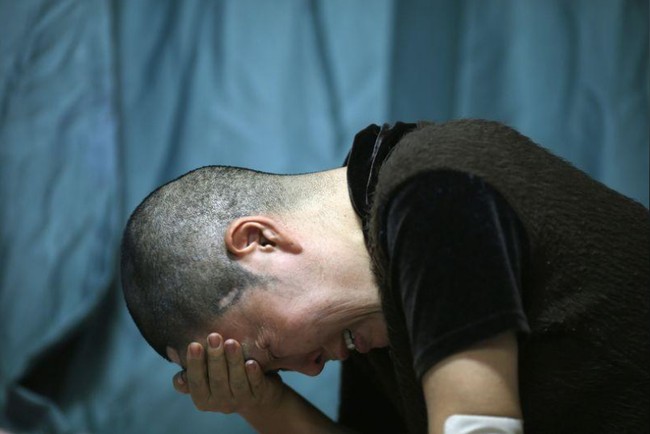 Lima tahun berlalu setelah operasi plastik tersebut, Kim kini harus berjuang menyembuhkan dirinya dari masalah kesehatan. Efek operasi plastik, dia tidak bisa menutup matanya dan hidungnya tidak berhenti mengeluarkan cairan. Wanita 49 tahun itu pun kini hidup menganggur dan menderita depresi. Foto: REUTERS/Kim Hong-Ji