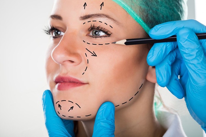 Close-up Of A Surgeon Drawing Perforation Lines On Young Womans Face For Plastic Surgery