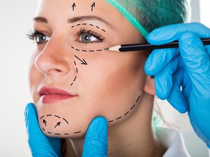 Ilustrasi operasi plastik. Foto: iStock Ilustrasi operasi plastik. Foto: iStock