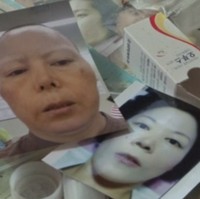 Kim tertarik melakoni operasi plastik karena tidak menyukai bentuk hidungnya. Dan dia semakin terobsesi operasi hidung karena ada kepercayaan di Korea bahwa mereka yang memiliki bentuk hidung mancung dengan bagian ujungnya mencuat ke atas sulit untuk menjadi kaya. Foto: REUTERS/Kim Hong-Ji