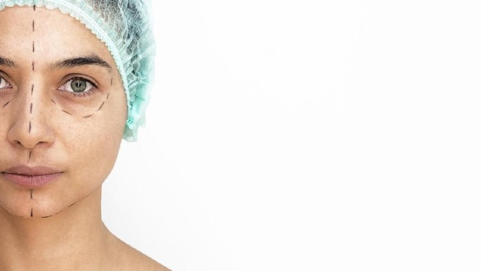 Close-up Of A Surgeon Drawing Perforation Lines On Young Womans Face For Plastic Surgery