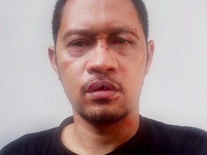 Operasi Plastik, Seniman Agan Harahap Manipulasi Foto Jadi Bonyok