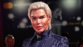 Sampai dengan Januari 2018, Alves sudah menjalani 103 prosedur bedah kosmetik dan menghabiskan 500 ribu pound sterling. (Foto: Vittorio Zunino Celotto/Getty Images)