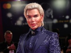 Operasi Plastik Bikin Sosok-sosok Ini Viral dan Kini Tenar