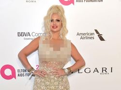 Operasi Plastik Bikin Sosok-sosok Ini Viral dan Kini Tenar