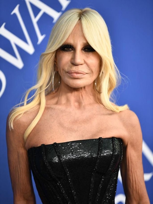 Donatella Versace memang tidak pernah bicara terang-terangan soal operasi plastik. Namun berdasarkan pengamatan dokter bedah plastik, wajah desainer 63 tahun itu merupakan hasil dari tindakan berulang kali. Seperti dikabarkan CBS News, bagian bibir bawah Donatella tampak 50 persen lebih besar dari bagian atas. Warna kulitnya juga tak merata sebagai efek dari banyaknya tindakan yang dijalani.  (Foto: Getty Images)