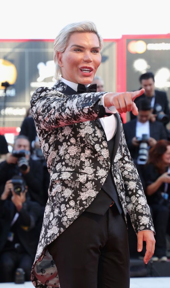 Pada 2014, Jessica yang saat itu masih bernama Rodrigo Alves mengaku setidaknya telah menjalani 12 kali rekonstruksi pada wajah dan tubuhnya. Biaya yang dihabiskannya untuk melakukan operasi plastik tersebut adalah sebanyak 100 ribu poundsterling atau hampir Rp 2 miliar. Foto: Vittorio Zunino Celotto/Getty Images