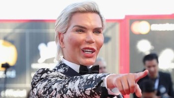 Pria Brasil berusia 35 tahun ini sudah menjalani sejumlah operasi plastik untuk menyempurnakan penampilannya. (Foto: Vittorio Zunino Celotto/Getty Images)