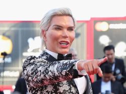 Operasi Plastik Bikin Sosok-sosok Ini Viral dan Kini Tenar