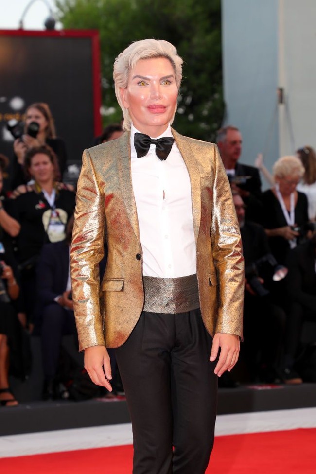 Rodrigo Alves yang kini ganti nama jadi Jessica Alves dulunya dikenal karena obsesinya menjadi mirip Ken, boneka pasangan Barbie. Untuk mewujudkan obsesinya, Rodrigo melakukan puluhan operasi plastik.  Foto: Vittorio Zunino Celotto/Getty Images