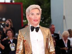 Operasi Plastik Bikin Sosok-sosok Ini Viral dan Kini Tenar