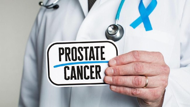 Mengenal Kanker Prostat, dari Penyebab, Gejala, dan Cara Mencegahnya