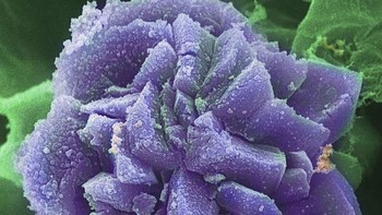 Penampakan Kristal kalsium oksalat yang menyebabkan sensasi terbakar di mulut dan tenggorokan. Karennaya kristal ini menjadi salah satu bahan yang dihindari saat dibuat obat. Foto: Ted Kinsman