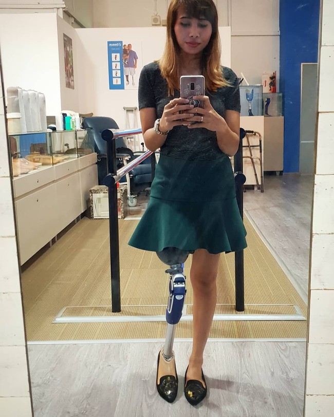 Sebelum sukses meraih mimpinya menjadi model, Rosalina Oktavia sempat mengalami masa-masa sedih ketika baru saja kehilangan kakinya. Kaki Rosalina harus diamputasi setelah dia mengalami kecelakaan motor pada 2010. Foto: Instagram @ kazzrozza