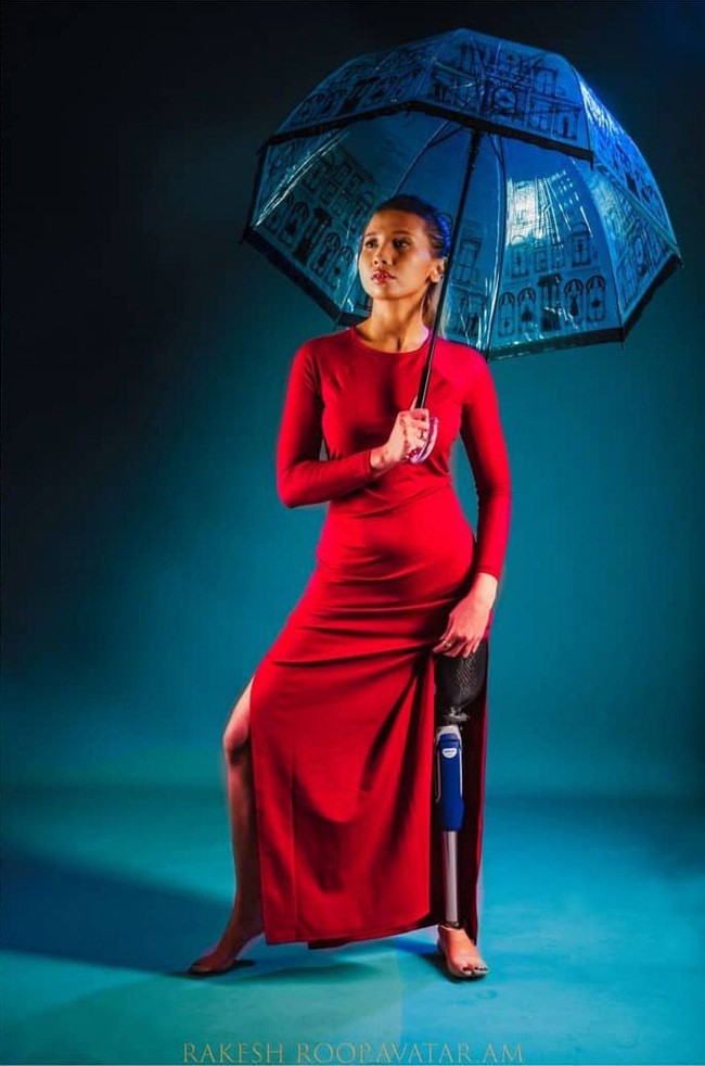 “Menjadi model membantu saya mencintai tubuh saya dan menerima siapa saya. Saya tahu ini memberi harapan dan keberanian lain sejak kaki saya diamputasi, kata Rosalina kepada The Sun. Foto: Instagram @ kazzrozza