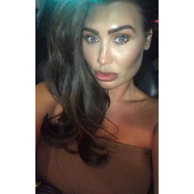 Dua tahun setelahnya, bokongnya pun ikut membesar. Ia melakukan Brazilain Butt lift yang menghabiskan biaya yang tak sedikit.  Foto: dok. Instagram