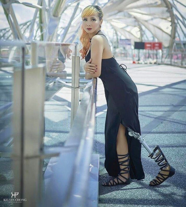 Setelah mengalami kecelakaan tersebut, Rosalina tak mengira dia akan berakhir dengan kehilangan anggota badannya. Saat menjalani operasi pasca kecelakaan, salah satu arteri Rosalina terputus, dan bagian kakinya membusuk.  Wanita berusia 27 tahun ini mengungkapkan bahwa dunianya berantakan menyusul amputasi kakinya. Foto: Instagram @kazzrozza