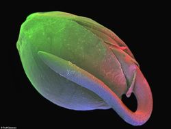 Seramnya Penampakan Ganja Saat Dilihat Pakai Mikroskop