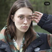 Freckles-freckles di wajahnya tersebut akibat masalah ginjal di masa lalu. Masalah tersebut berpengaruh juga pada kulit Maeva yang merangsang hiperpigmentasi. Kemudian timbul bintik hitam di pipi hinga bagian matanya. Foto: Instagram (@maevamarshall)