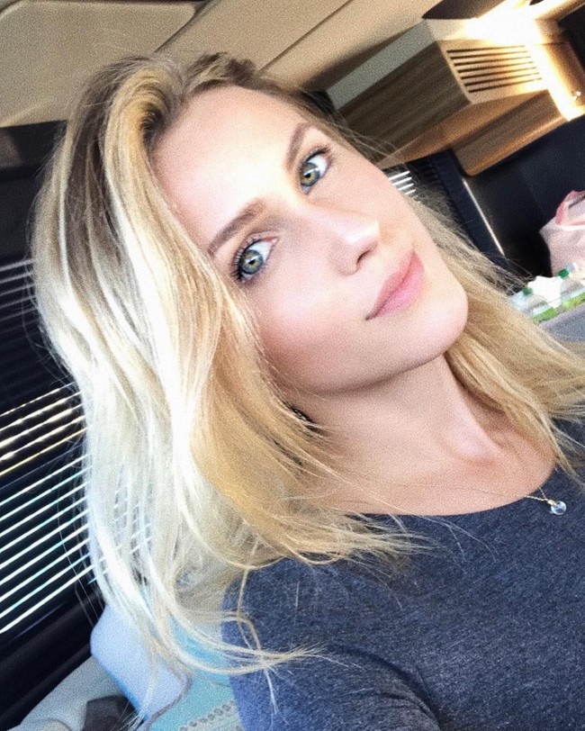 Mahasiswi bernama Melissa Gentz ini jadi viral setelah berbagi foto-foto cedera mengerikan yang ia alami setelah sang kekasih yang merupakan miliarder memukulinya. Foto: Instagram @melissalgentz