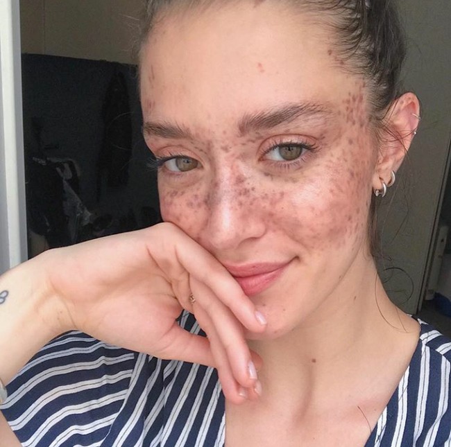 Wanita yang berbasis di New York itu sebelum memiliki freckles telah berkarier sebagai model. Namun kala itu dia seperti tak pernah dilirik. Foto: Instagram (@maevamarshall)