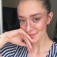 Wanita yang berbasis di New York itu sebelum memiliki freckles telah berkarier sebagai model. Namun kala itu dia seperti tak pernah dilirik. Foto: Instagram (@maevamarshall)