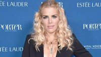 Kisah Aktris 'Dawson's Creek' Idap Tumor Otak Langka, Bersyukur Masih Hidup